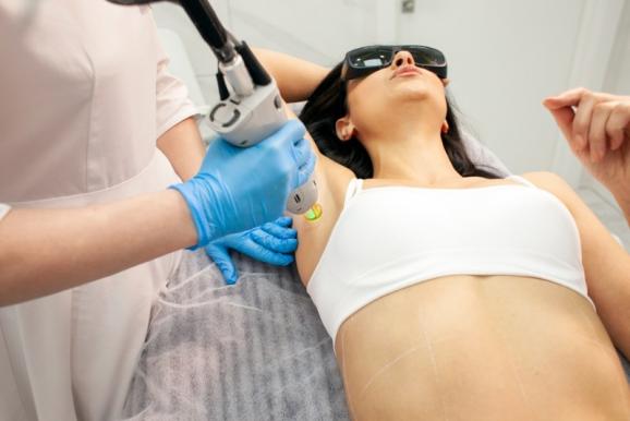epilation laser Vertou